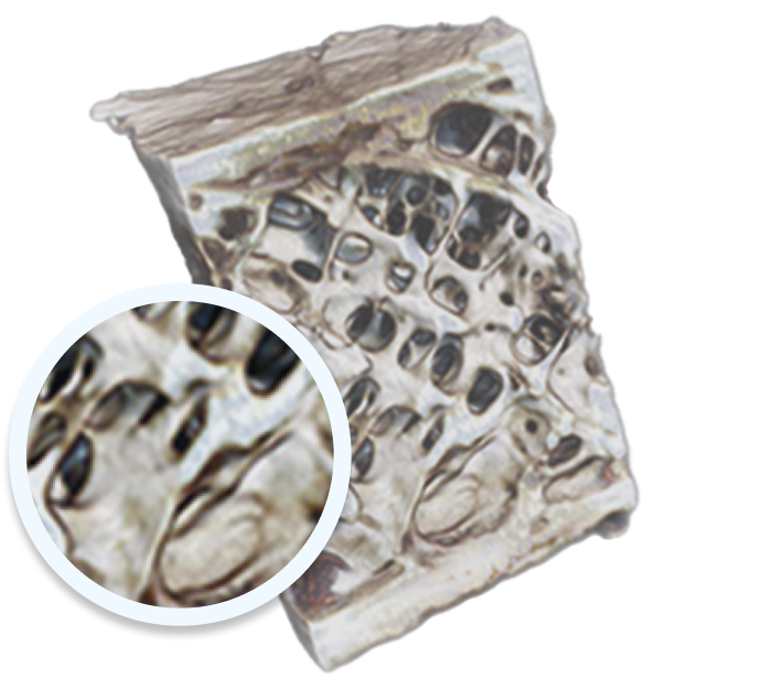 Untreated osteoporotic bone vs. osteoporotic bone with EVENITY® (romosozumab-aqqg)